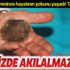 Mesanesinde 220 gramlık tek parça taş çıktı Mesanesinde 220 gramlık tek parça taş çıktı