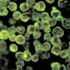 Naegleria fowleri: ABD'de 'beyin yiyen amip' vakası görüldü Naegleria fowleri: ABD'de 'beyin yiyen amip' vakası görüldü