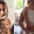 Ünlü model asitli saldırıda yaralandı Ünlü model asitli saldırıda yaralandı