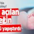 Bebeğin gözüne doku yapıştırıcısı döktü! Özel hastaneye ‘yetkisiz hekim’ şikâyeti
