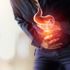 Gastrit nedir? Gastrite ne iyi gelir? Gastrit nedir? Gastrite ne iyi gelir?