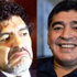 İşte estetik ameliyatın ardından Maradona'nın yeni yüzü
