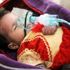 Yemen'de kolera can almaya devam ediyor Yemen'de kolera can almaya devam ediyor