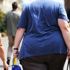 Beriatrik ve Metabolik Cerrahi Derneği, obezite cerrahisi ile ilgili basın açıklaması yaptı