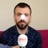 Hasta yakını, yüksek ses nedeniyle uyaran hemşirenin burnunu kırdı
