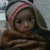 Suriye'de açlıktan ölümlerin başladığı Madaya'ya yardım gidecek