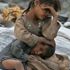Yemen’deki kolera salgını korkutucu boyuta ulaştı Yemen’deki kolera salgını korkutucu boyuta ulaştı