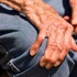 Dünya Parkinson Hastalığı Günü