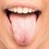 Dil büyümesi nedir? Dil büyümesi nedenleri, belirtileri ve tedavisi… Dil büyümesi nedir? Dil büyümesi nedenleri, belirtileri ve tedavisi…