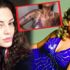 Sinem Umaş'ın kolları yandı Sinem Umaş'ın kolları yandı
