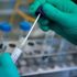 PCR testi isteyen ülkelere gidecekler ücretli test yaptırabilecek PCR testi isteyen ülkelere gidecekler ücretli test yaptırabilecek