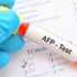 AFP: Alfa Fetoprotein nedir? AFP yüksekliği ve düşüklüğü neden olur? AFP: Alfa Fetoprotein nedir? AFP yüksekliği ve düşüklüğü neden olur?