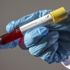Avustralya'da günlük koronavirüs vakalarında rekor artış yaşandı