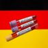Almanya'da koronavirüsten hayatını kaybedenlerin sayısı 4 bin 352 oldu