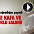 Arazi Yangınını Kürekle Söndürdüler