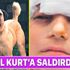 Kurt’a saldırdı