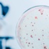 D vitamini eksikliği kansere neden oluyor D vitamini eksikliği kansere neden oluyor
