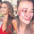 Çeşme’de dayak yediğini söyleyen Ukraynalı model Daria Kyryliuk savcılıkta çark etti! Çeşme’de dayak yediğini söyleyen Ukraynalı model Daria Kyryliuk savcılıkta çark etti!