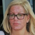 Tori Spelling'in yüzüne ne oldu
